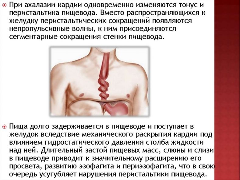 Почему Бывает Отрыжка: Причины, Лечение + 10 Способов Избежать